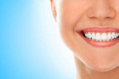 Clear Aligners