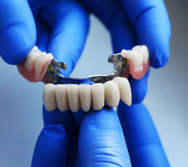 Mission Viejo Dental Crowns