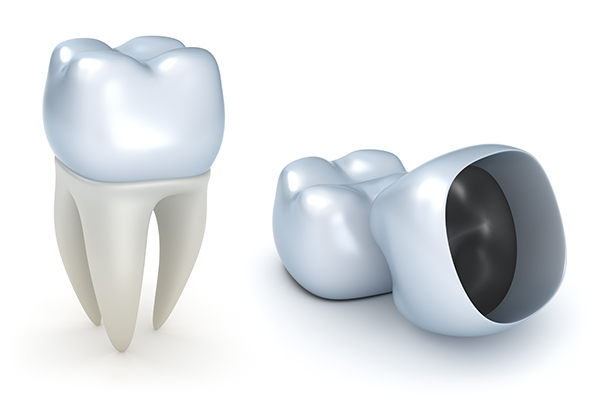 Questions To Ask During A Dental Crown Consultation