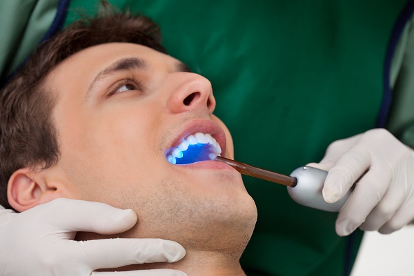 Dental Filling Procedure Steps