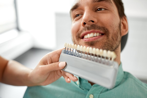 FAQs &#    ; Dental Veneers Procedure