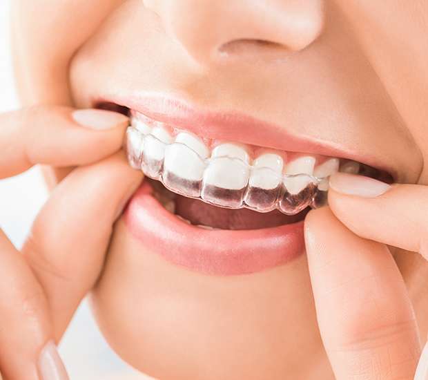 Mission Viejo Does Invisalign® Really Work?
