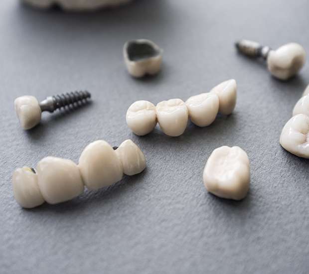 Mission Viejo The Difference Between Dental Implants and Mini Dental Implants
