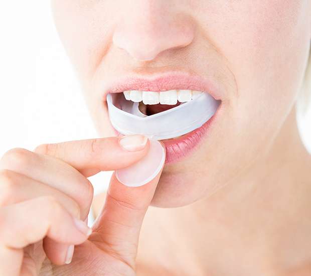 Mission Viejo Mouth Guards