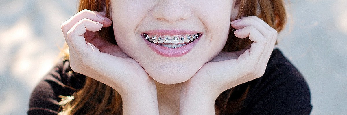 Mission Viejo Orthodontics
