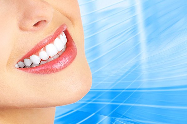 teeth whitening Mission Viejo, CA