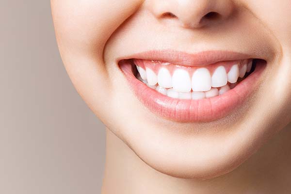 Some Ways Teeth Whitening Can Improve Your Smile